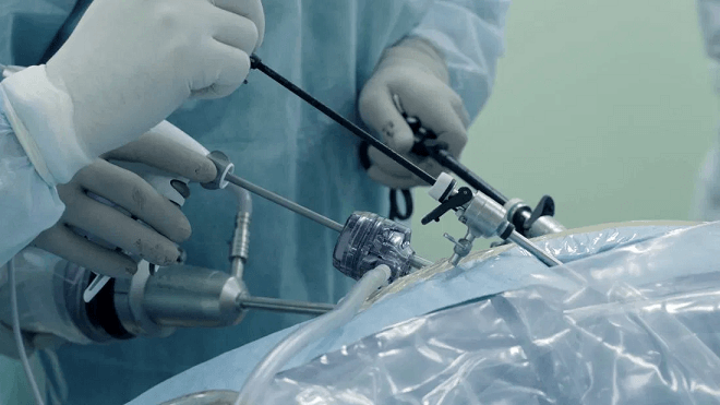 cost of laparoscopy in nigeria
