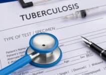 Cost of Tuberculosis Test in Lagos Nigeria (December 2022)