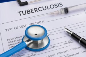 Cost of Tuberculosis Test in Lagos Nigeria (June 2023)