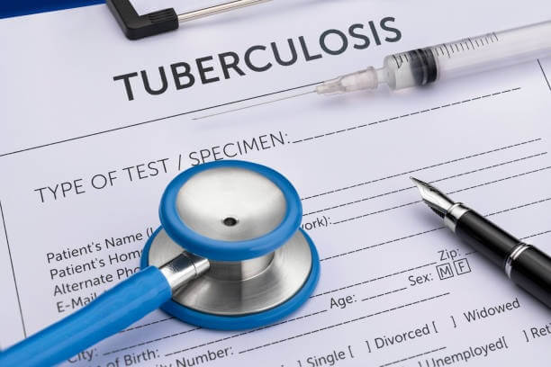 Cost of Tuberculosis Test in Lagos Nigeria
